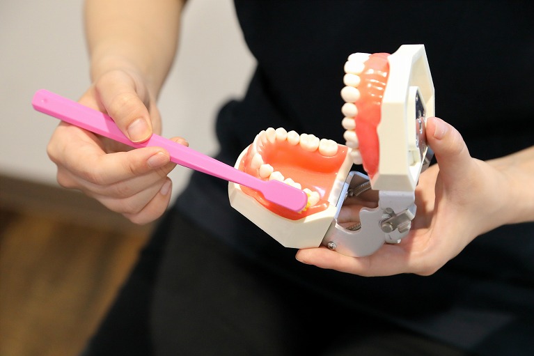 むし歯(虫歯)を銀歯で治した場合の歯の寿命は約5年半・約50％が再治療に