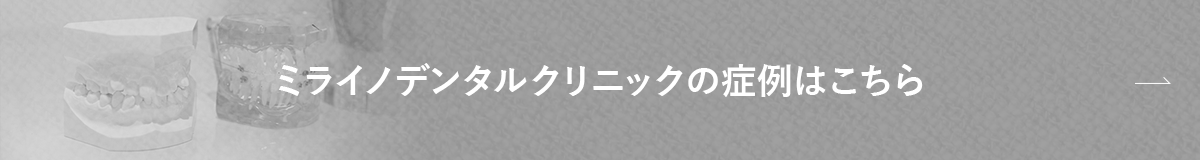 ミライノデンタルクリニックの症例はこちら