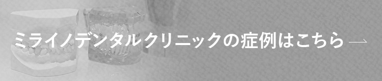 ミライノデンタルクリニックの症例はこちら